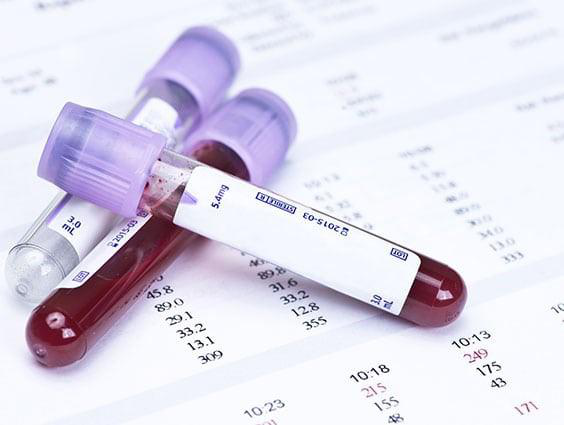 青藏高原常驻人群血常规血生化数据（2021）